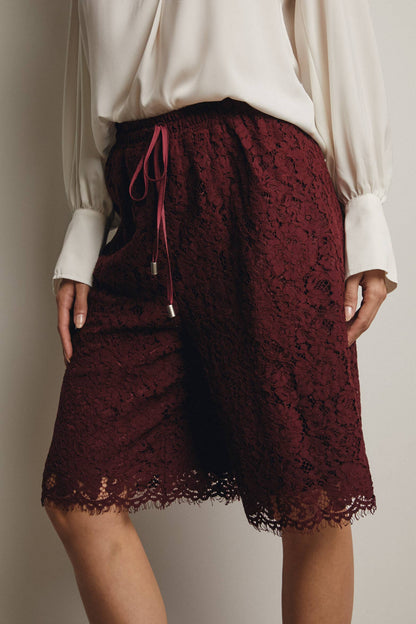 Simply Irresistible, Be the showstopper: Lace Bermuda Shorts