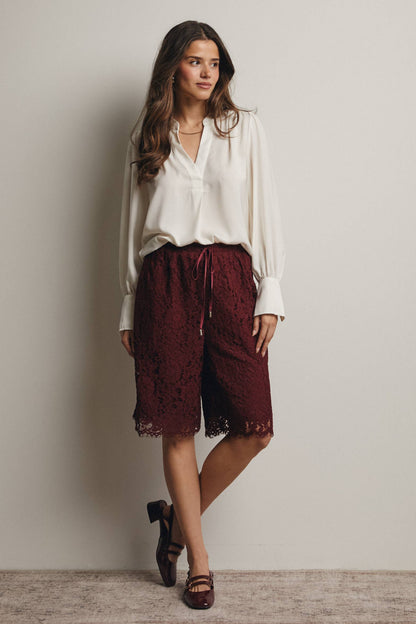 Simply Irresistible, Be the showstopper: Lace Bermuda Shorts