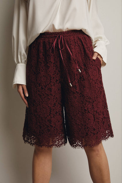 Simply Irresistible, Be the showstopper: Lace Bermuda Shorts