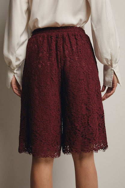 Simply Irresistible, Be the showstopper: Lace Bermuda Shorts